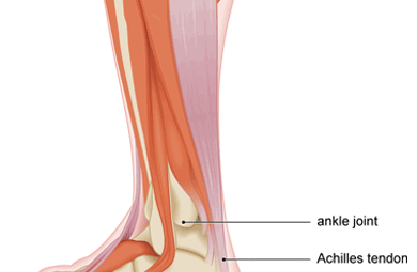 gastrocnemius muscle strain archives steven chudik md