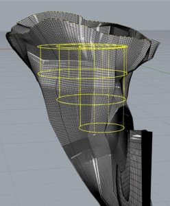 3D glenoid image created to determine best placement for a shoulder arthroplasty prosthesis