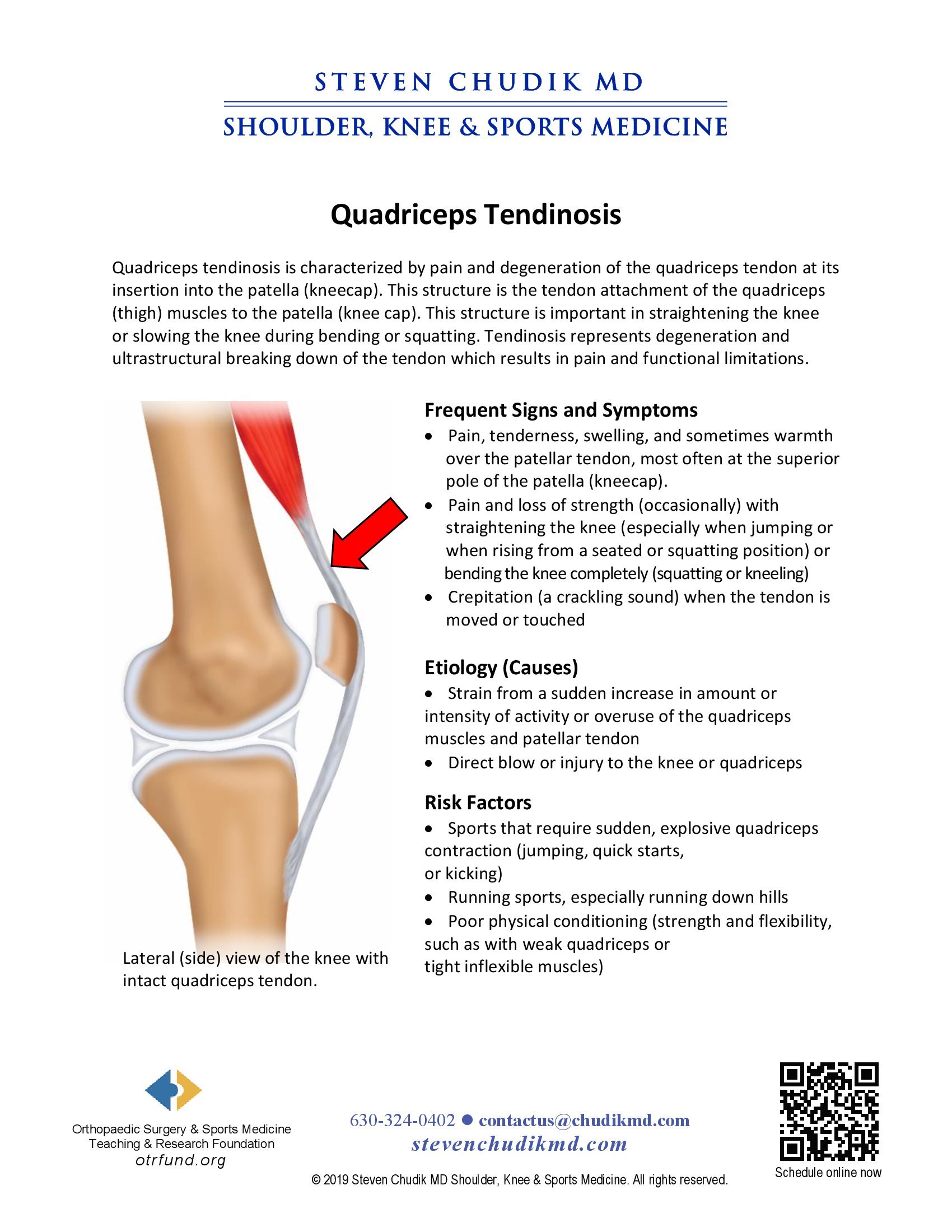 Quadriceps tendon pain store