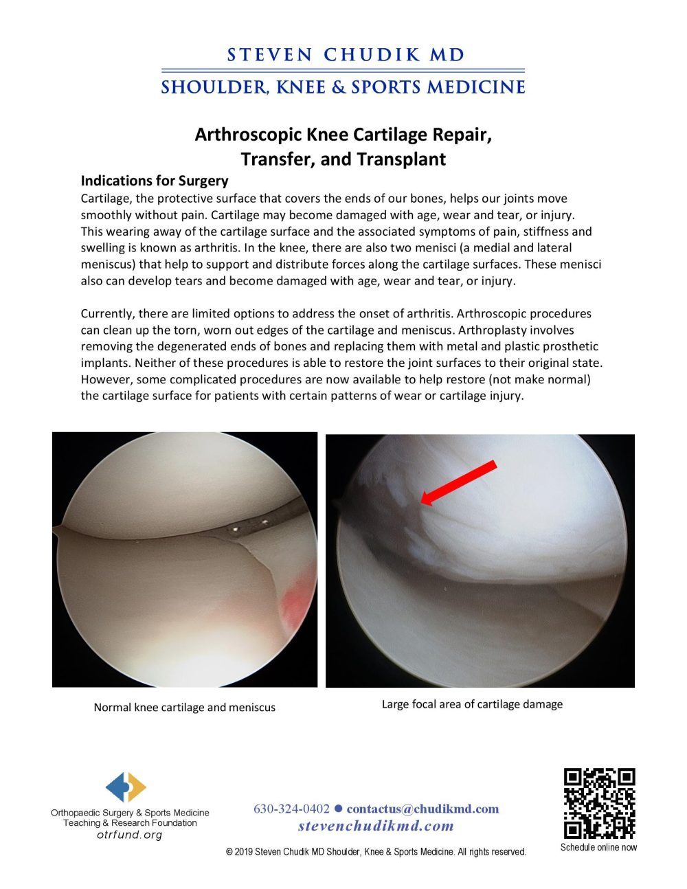 Arthroscopic Knee Cartilage Repair Steven Chudik MD Arthroscopic Knee Cartilage Repair Steven Chudik MD