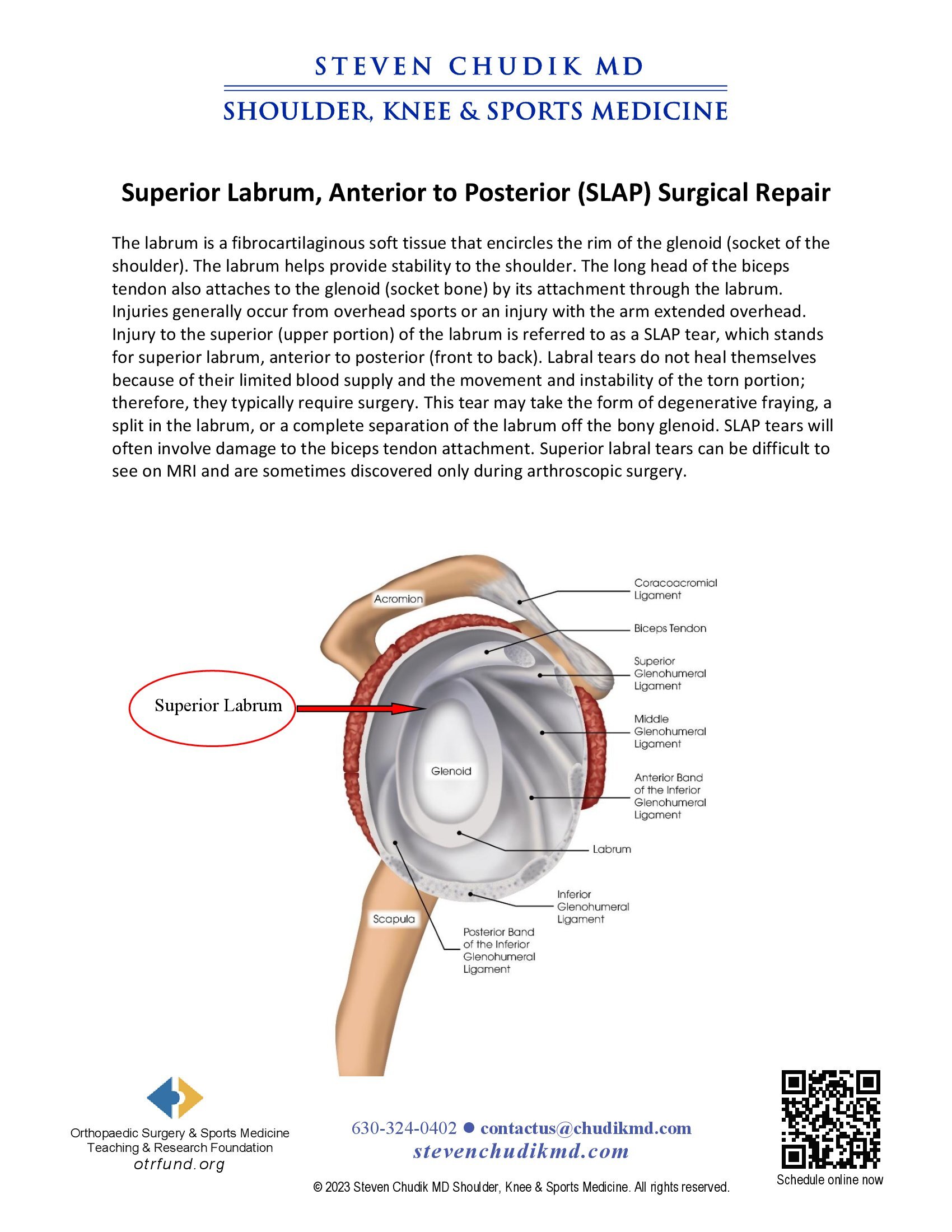 Superior Labral Tear (SLAP Tear) - Steven Chudik MD