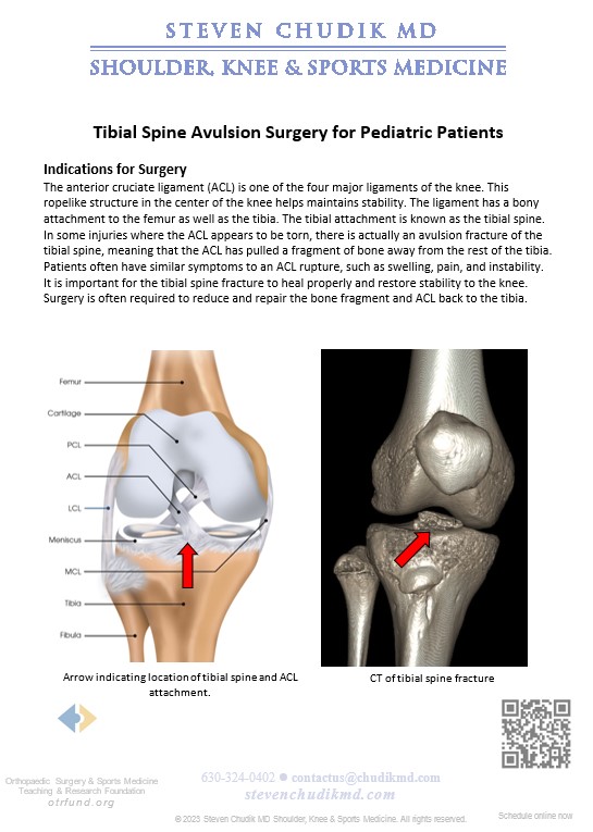 Arthroscopic Tibial Spine Avulsion Surgery For Pediatric Patients